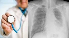 Mesothelioma lawyer Chicago