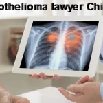 Mesothelioma lawyer Chicago